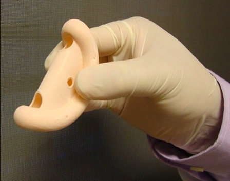 Pesario Vaginal: Un Dispositivo De Ayuda
